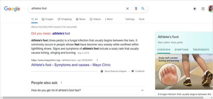 運動員腳與片段