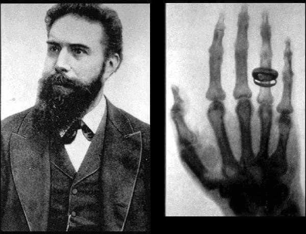 فيلهلم كونراد رونتجن Wilhelm Conrad Roentgen, discoverer of X rays
