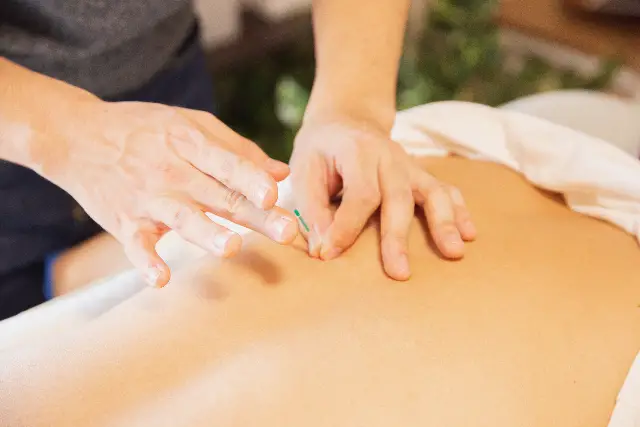 6 strategii online pentru a vă extinde clientela de acupunctură